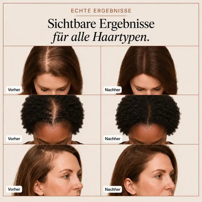Kavira Haarserum